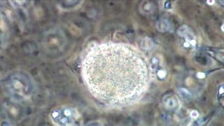 Katarzyna Warnke, Marieta Zukowska, Olga Boladz - Botoks (2017) sexy topless scenes