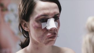 Katarzyna Warnke, Marieta Zukowska, Olga Boladz - Botoks (2017) sexy topless scenes